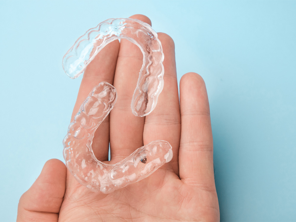 Invisalign clear aligners in a hand