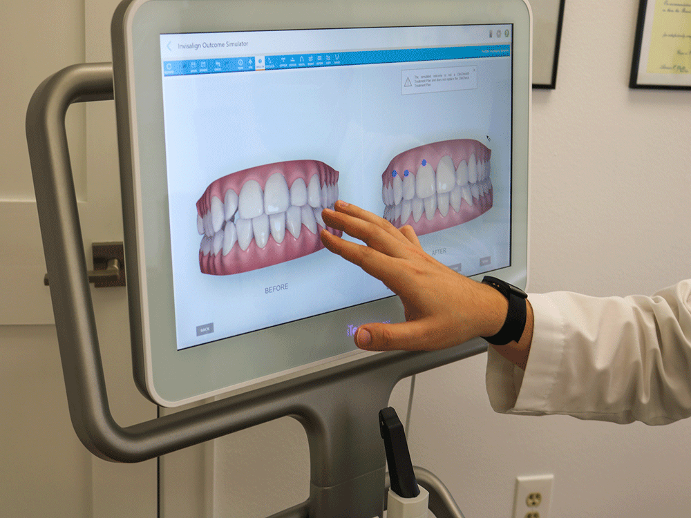 Dentist showing digital impressions of a patient's teeth